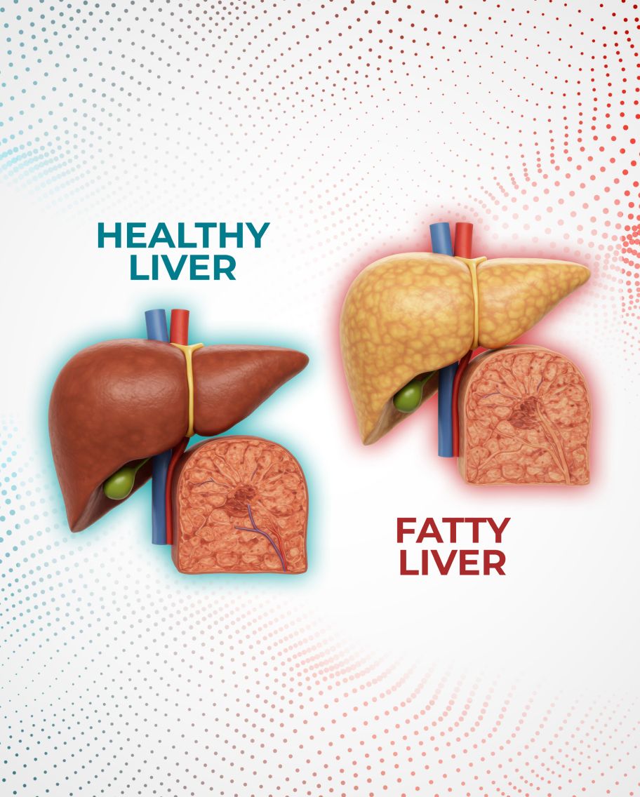 liver comparison