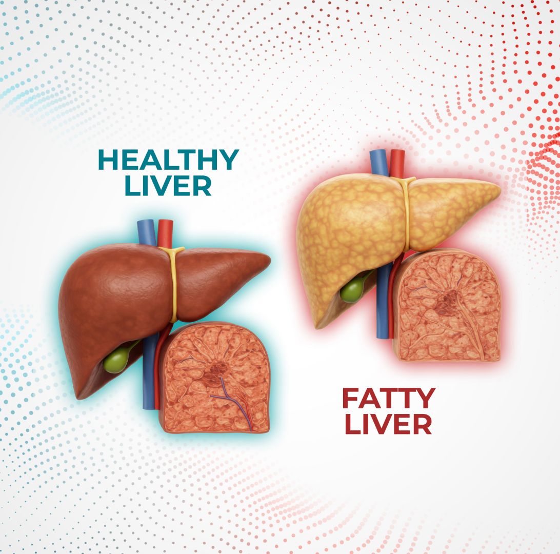 liver comparison